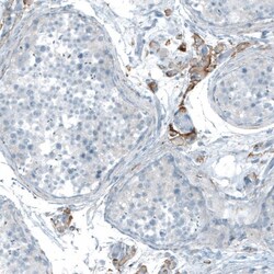 Neuroligin 3/NLGN3 Antibody, Novus Biologicals 25 &mu;L; Unlabeled:Antibodies,
