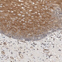 Neuromedin-U Antibody, Novus Biologicals 0.1mL; Unlabeled:Antibodies, Polyclonal