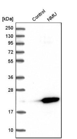 Neuromedin-U Antibody, Novus Biologicals 0.1mL; Unlabeled:Antibodies, Polyclonal