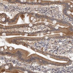 Neuromedin UR1/NMUR1 Antibody, Novus Biologicals 25 &mu;L; Unlabeled:Antibodies,