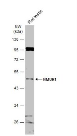 Neuromedin UR1/NMUR1 Antibody, Novus Biologicals 0.1mL; Unlabeled:Antibodies,