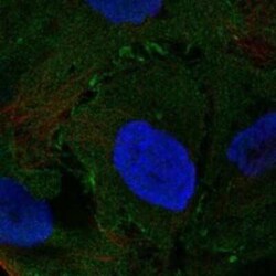 Neuromedin UR2/NMUR2 Rabbit anti-Human, Polyclonal, Novus Biologicals:Antibodies:Primary