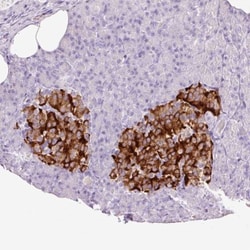 Neuronal Pentraxin 2 Antibody, Novus Biologicals 0.1mL; Unlabeled:Antibodies,
