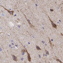 Choline Kinase beta Antibody, Novus Biologicals:Antibodies:Primary Antibodies