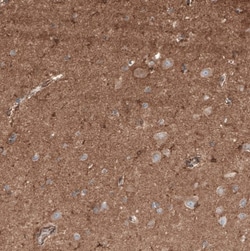 Neuropilin-2 Antibody, Novus Biologicals 25 &mu;L; Unlabeled:Antibodies,
