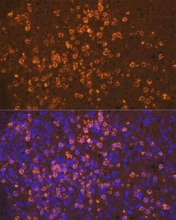 Neutrophil Elastase/ELA2 Rabbit anti-Human, Mouse, Clone: 8X4E6, Novus