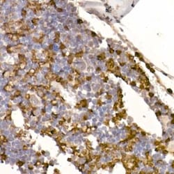 Neutrophil Elastase/ELA2 Rabbit anti-Human, Mouse, Clone: 8X4E6, Novus