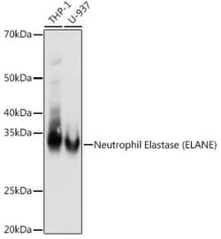Neutrophil Elastase/ELA2 Rabbit anti-Human, Mouse, Clone: 8X4E6, Novus