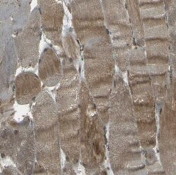 Nexilin Antibody, Novus Biologicals:Antibodies:Primary Antibodies