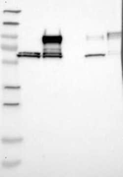 Nexilin Rabbit anti-Human, Polyclonal, Novus Biologicals 25 &mu;g; Unconjugated:Antibodies,