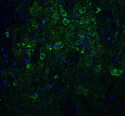 Nicastrin Antibody - BSA Free, Novus Biologicals:Antibodies:Primary Antibodies