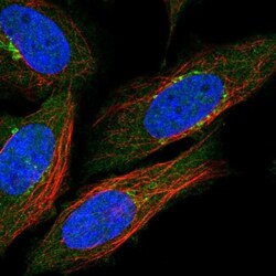 Nicotinamide N-Methyltransferase/NNMT Antibody, Novus Biologicals 0.1mL;