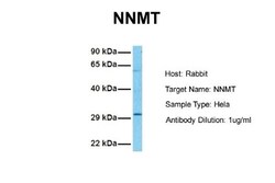 Nicotinamide N-Methyltransferase/NNMT Antibody, Novus Biologicals 0.1mg;