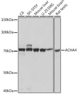 Nicotinic Acetylcholine R alpha 4/CHRNA4 Rabbit anti-Human, Mouse, Rat,