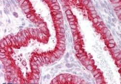Nicotinic Acetylcholine Receptor beta 2 Antibody, Novus Biologicals 0.1mg;