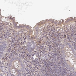 Ninein Antibody, Novus Biologicals:Antibodies:Primary Antibodies