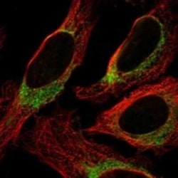 Ninjurin-2 Rabbit anti-Human, Polyclonal, Novus Biologicals:Antibodies:Primary
