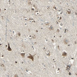 Nitrilase 1 Antibody, Novus Biologicals 0.1mL; Unlabeled:Antibodies, Polyclonal