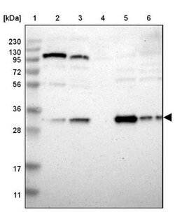 Nitrilase 1 Antibody, Novus Biologicals 0.1mL; Unlabeled:Antibodies, Polyclonal