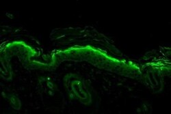 Nitrotyrosine Antibody (39B6), Novus Biologicals 0.1mg; Unlabeled:Antibodies,