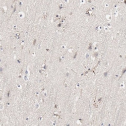 Njmu-R1 Antibody, Novus Biologicals:Antibodies:Primary Antibodies