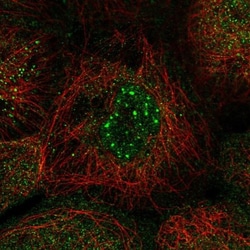 Nocturnin Antibody, Novus Biologicals 25 &mu;L, Unlabeled:Antibodies, Polyclonal