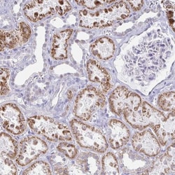 Nocturnin Antibody, Novus Biologicals 25 &mu;L, Unlabeled:Antibodies, Polyclonal
