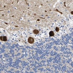 Nocturnin Antibody, Novus Biologicals:Antibodies:Primary Antibodies