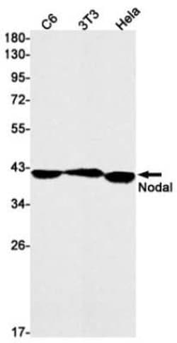 Nodal Rabbit anti-Human, Rat, Clone: S06-5A3, Novus Biologicals:Antibodies:Primary