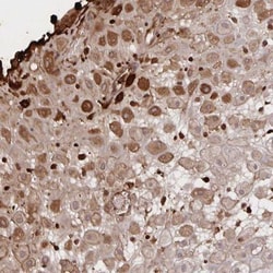 Noggin Antibody, Novus Biologicals 0.1mL; Unlabeled:Antibodies, Polyclonal