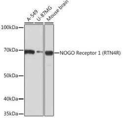Nogo Receptor/NgR Rabbit anti-Human, Mouse, Clone: 1R9A3, Novus Biologicals:Antibodies:Primary
