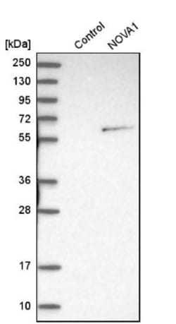 Nova1 Antibody, Novus Biologicals 25 &mu;L | Buy Online | Novus Biologicals | Fisher Scientific