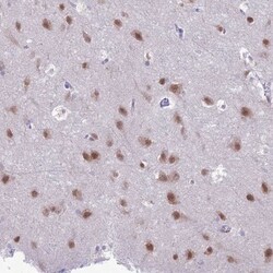 Nova2 Antibody, Novus Biologicals 0.1mL; Unlabeled:Antibodies, Polyclonal