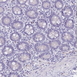 Nova2 Antibody, Novus Biologicals 0.1mL; Unlabeled:Antibodies, Polyclonal
