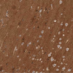 NrCAM Antibody, Novus Biologicals 0.1mL; Unlabeled:Antibodies, Polyclonal