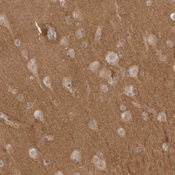 NrCAM Antibody, Novus Biologicals 0.1mL; Unlabeled:Antibodies, Polyclonal
