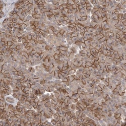 NrCAM Antibody, Novus Biologicals 0.1mL; Unlabeled:Antibodies, Polyclonal