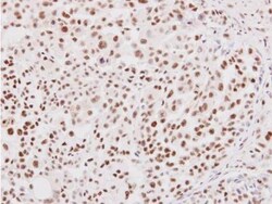 Nrf1 Antibody, Novus Biologicals 0.1mL; Unlabeled:Antibodies, Polyclonal