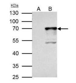 Nrf1 Antibody, Novus Biologicals 0.1mL; Unlabeled:Antibodies, Polyclonal