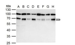 Nrf1 Antibody, Novus Biologicals 0.1mL; Unlabeled:Antibodies, Polyclonal