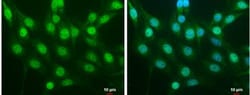 Nrf2 Antibody, Novus Biologicals 0.1mg; Unlabeled:Antibodies, Polyclonal
