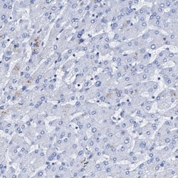 Nrip2 Antibody, Novus Biologicals 0.1mL; Unlabeled:Antibodies, Polyclonal