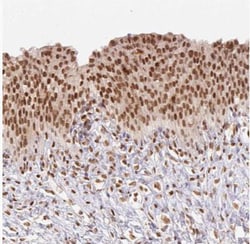 Nuclear Factor Erythroid 2 Related Factor 1 Antibody, Novus Biologicals:Antibodies:Primary