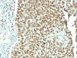 Nucleolin Antibody (NCL/902), Novus Biologicals 0.2mg; Unlabeled:Antibodies,