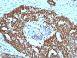 Nucleolin Antibody (NCL/902), Novus Biologicals 0.2mg; Unlabeled:Antibodies,
