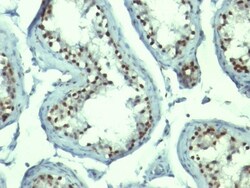 Nucleolin Antibody (NCL/902), Novus Biologicals 0.2mg; Unlabeled:Antibodies,