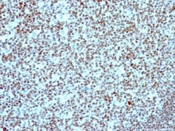 Nucleolin Antibody (NCL/902), Novus Biologicals 0.2mg; Unlabeled:Antibodies,
