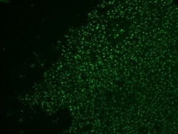 Nucleolin Antibody (364-5 + NCL/902), Novus Biologicals 0.2mg; Unlabeled:Antibodies,