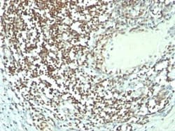 Nucleolin Antibody (364-5 + NCL/902), Novus Biologicals 0.2mg; Unlabeled:Antibodies,