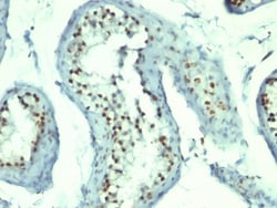 Nucleolin Antibody (364-5 + NCL/902), Novus Biologicals 0.2mg; Unlabeled:Antibodies,